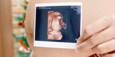 Nguy cơ khi mang thai sau 35 tuổi